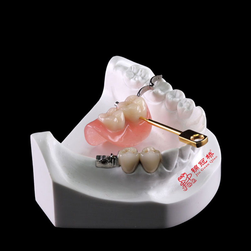 Denture_0075